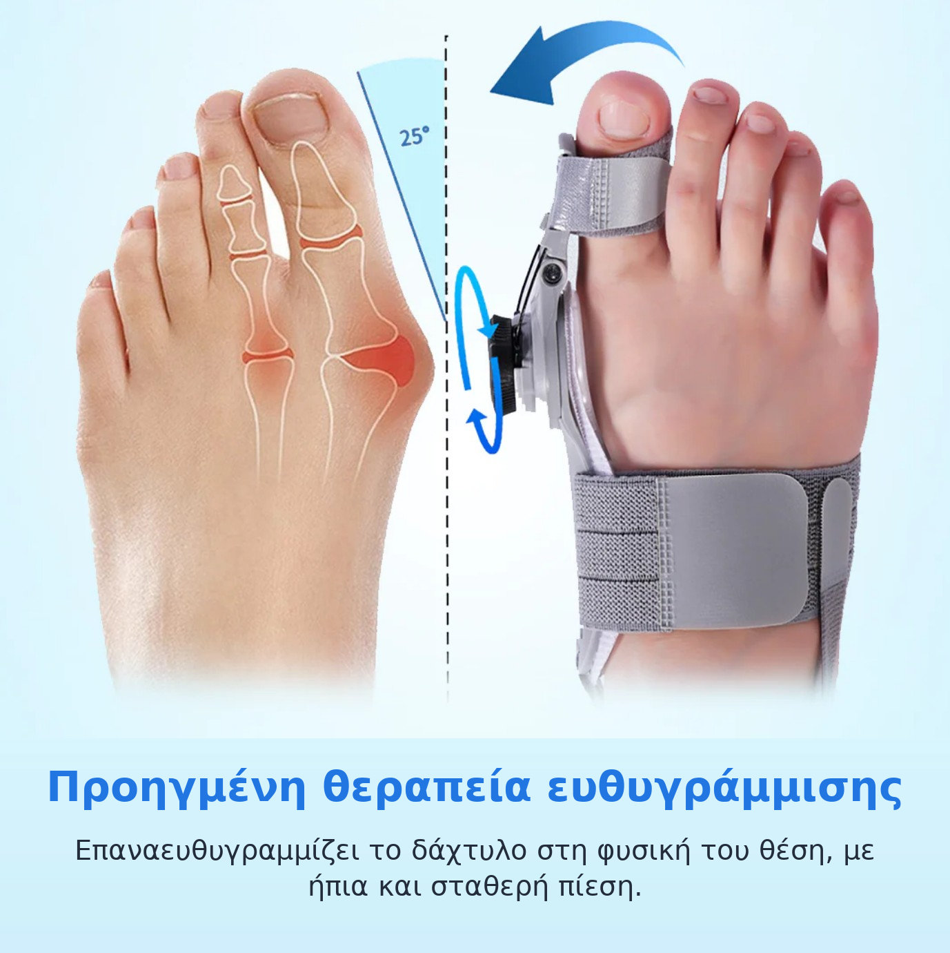 OrthoStep™ – Διορθωτής για το κότσι (βλαισό μέγα δάκτυλο) χωρίς χειρουργείο